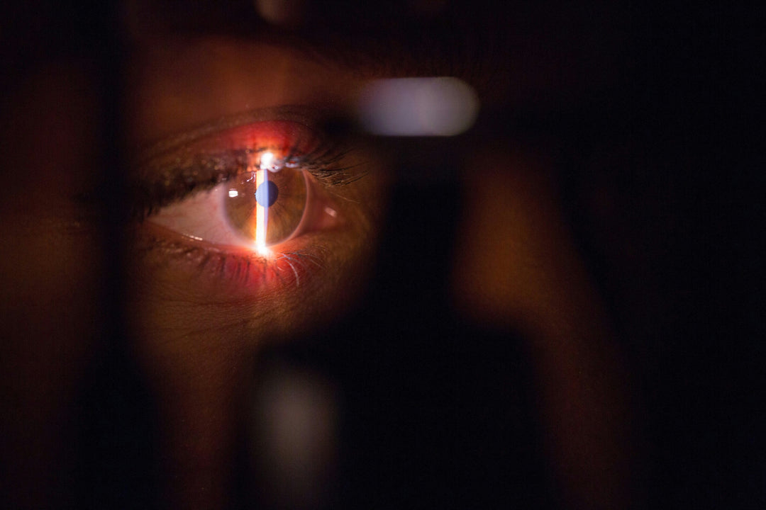 June is Cataract Awareness Month: What You Need to Know in 2025 to Protect Your Vision